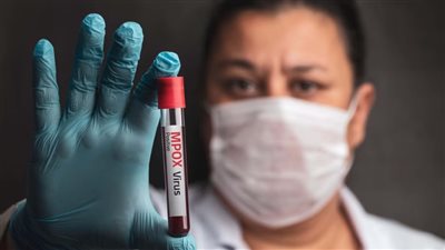 ما هو فيروس mpox وما أعراضه؟