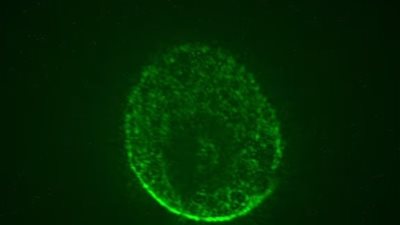 تجربة غريبة.. زرع أدمغة بشرية في مختبر فضائي لعلاج الزهايمر