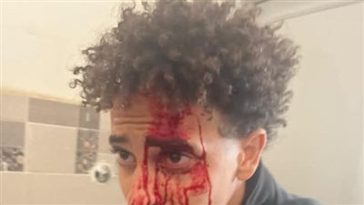 تفاصيل الاعتداء على معلم بالأسلحة البيضاء بمدرسة في النزهة 