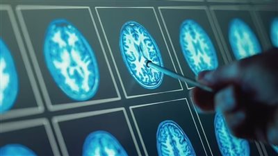 ما هي موجات الشيخوخة الثلاث في الدماغ؟