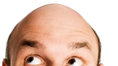 ما علاقة نظام الصيام المتقطع بتساقط الشعر؟