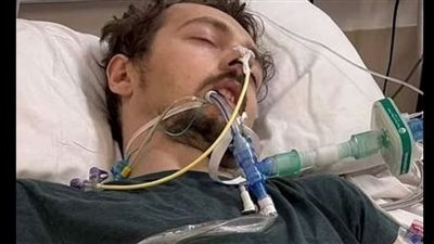 قصة حقيقية.. كيف يكون الكابوس مؤشر لمرض قاتل في الرأس؟