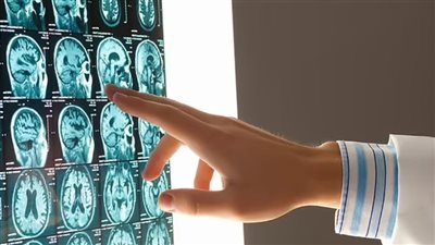 عوامل شخصية تزيد من خطر التعرض لمرض الخرف.. هل تعاني أي منها؟