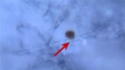 بسبب المواد البلاستيكية الدقيقة.. تحذير عاجل من شرب الشاي 