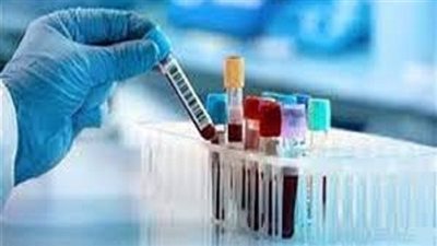 نقابات الصحفيين والمهندسين والمحامين توقف التعامل مع 3 معامل تحاليل كبيرة