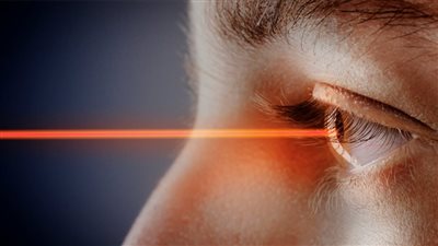 عمليات تصحيح الإبصار.. أشهر الأسئلة وإجابتها