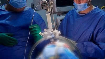 مستشفى جامعة المنصورة تنجح في إجراء جراحة دقيقة تجرى لأول مرة بالعالم 