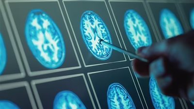 بم يفسر العلماء وصول البلاستيك إلى أدمغة البشر؟