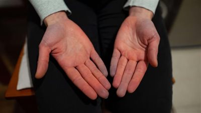 طرق طبيعية تعالج مشاكل الدورة الدموية بفصل الشتاء