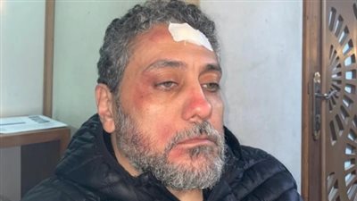 إصابة تامر فرج أثناء تصوير مسلسل 