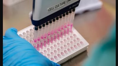 لقاح جديد يمنع تراكم الدهون في الشرايين ويحمي من السكتة الدماغية