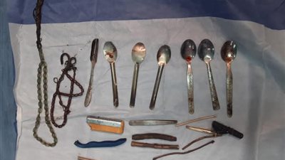 جراحة معقدة تنقذ شابًا مريضًا ابتلع ولاعات ومقصات بمستشفى سوهاج الجامعى