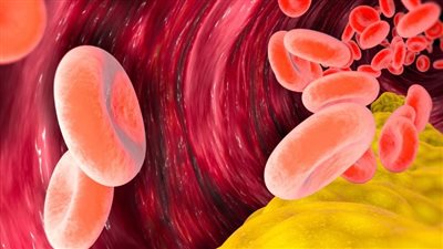 هذا ما تحتاج لمعرفته حول الكوليسترول وكيف يؤثر على صحتك؟