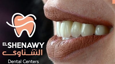 ما هي أسعار تبييض الأسنان في مصر 2025؟