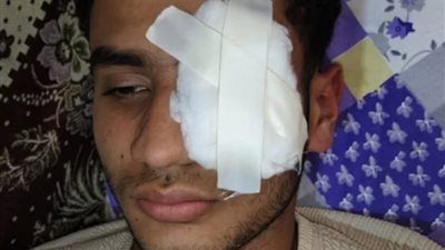 رفض الاعتد.اء على السيدات.. ضبط المتهم بـ «فقأ» عين شاب في الغربية