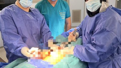 فريق طبي بمركز الأورام يُجري جراحة نادرة للحفاظ على خصوبة مريضات السرطان