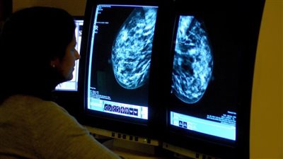 ما هو سرطان المرحلة صفر؟ وما خيارات العلاج؟