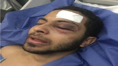 حكم رادع للمتهم بالتعدي على صديقه وإصابته بعاهة مستديمة في القليوبية