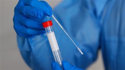 ما هي أعراض فيروس كورونا الحالية؟ وما شدة الفيروس وانتشاره؟