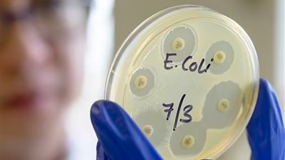 قلق صحي عالمي بسبب بكتيريا الإشريكية القولونية 