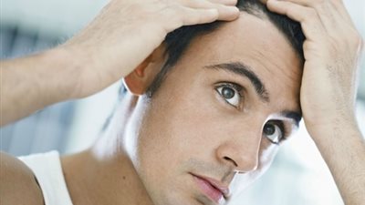 انتبه .. الضغط العصبي والسمنة من أهم أسباب قشرة الشعر