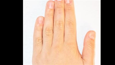 ماذا يعني طول الأصابع بالنسبة لصحتك؟