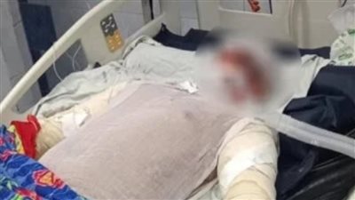 أيقونة الشجاعة.. رحيل بطل حريق مترو شبرا الخيمة متأثرا بإصابته