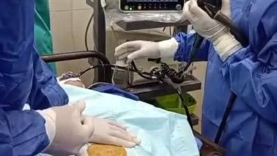 نقلة نوعية لخدمات المناظير بالمنوفية..«حميات منوف»تنقذ مرضى الجلطات بطريقة حديثة دون جراحة
