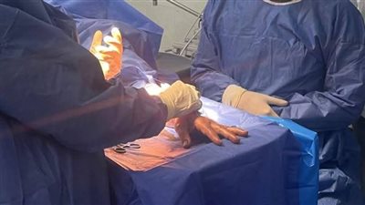 تدخل جراحي عاجل ينقذ حياة مريضة بمستشفى عزبة البرج المركزي بدمياط