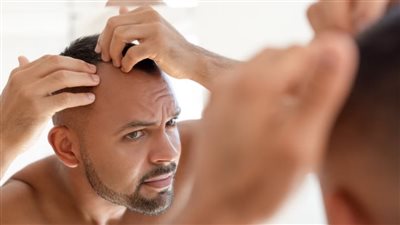 هل المشروبات الغازية سببًا في تساقط الشعر؟