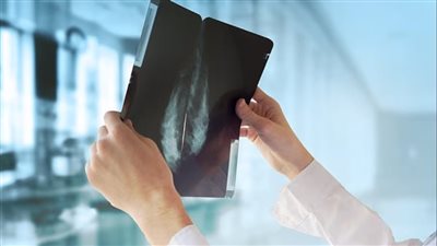 الذكاء الاصطناعي أصبح قادرًا على فحص قلب وثدي النساء