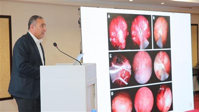 «الصحة» تختتم برنامجًا تدريبيًا لتعزيز الكشف المبكر وعلاج سرطان الرئة