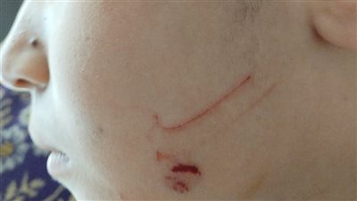  إصابات بين الطلاب وخروج قبل المواعيد الرسمية.. حرب تكسير عظام بين المعلمين والطلاب الضحايا