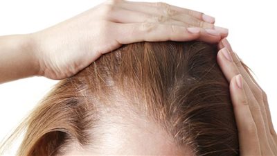 دراسة جديدة تؤكد الصلة بين إزالة الدهون وتساقط الشعر