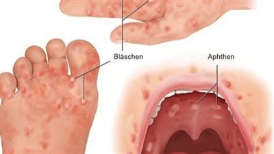 اول تعليق من التعليم حول غلق فصل بعد اصابه 4 طلاب بفيروس 