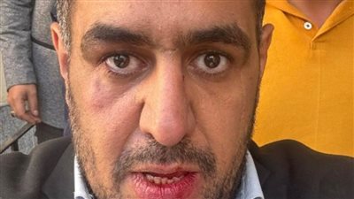 معركة “الأسبقية” تُشعل انتخابات النواب في الغربية.. وتدافع بين المرشحين أمام المحكمة