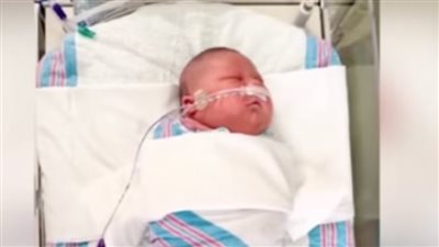 أزمة الطفل كاسيان.. لماذا تلد بعض النساء أطفال عمالقة؟