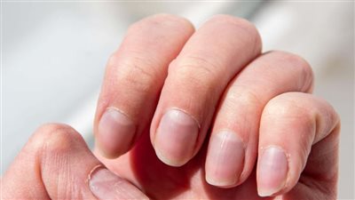 علامات يجب الحذر منها عندما تظهر على الأظافر