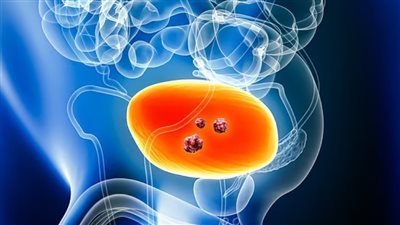 دراسة خطيرة.. نزلات البرد لدى الأطفال قد تؤدي إلى سرطان المثانة