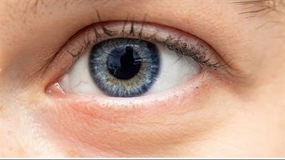 ملايين الأشخاص يعانون من الحالة.. ما هو انعدام التخيل؟ وكيف يتم تشخيصه؟