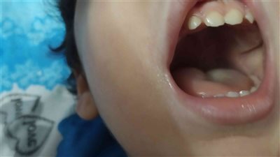 مأساة بحلوان.. طفل عامين يلقى مصرعه بعد اعتداء والده