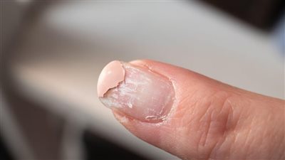 كيف يؤثر طلاء الأظافر الجل على صحتهم؟