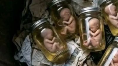 طبيب نساء بالمنيا: الأجنة محفوظة بطريقة مقصودة وليست عشوائية داخل برطمانات 