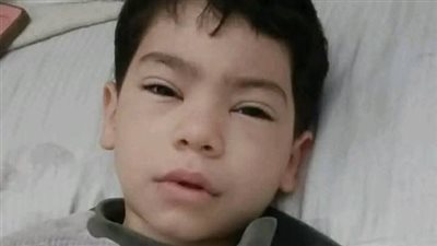 حقيقة بتر ساق طفل باسوس المصاب بطلق خرطوش في القليوبية