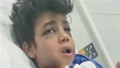 الطفل ياسين محمد مرزوق 