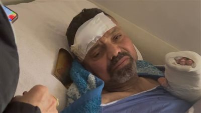 خلافات الجيرة وراء الاعتداء بسلاح أبيض وإحداث عاهة مستديمة بحلوان