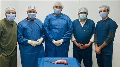 نجاح جراحة مزدوجة بالمنظار لتكميم المعدة وإصلاح فتق بالحجاب الحاجز بمستشفى الشهداء المركزي بالمنوفية 