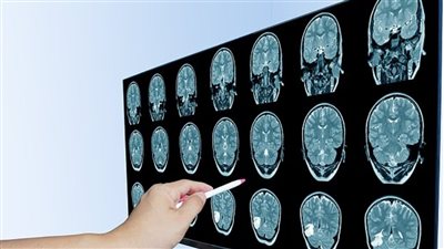 علميًا.. لماذا يلازمك شعور التعب دائمًا؟