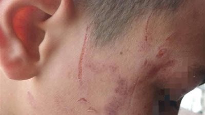 محافظ سوهاج: إيقاف ونقل معلمة اعتدت على طالب بخرطوم الأنبوبة