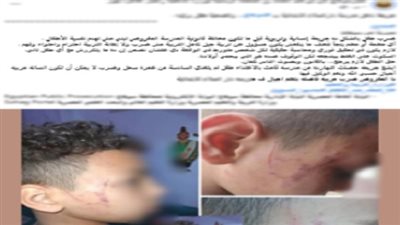 تعدي «معلمة» على طالب في دار السلام بسوهاج